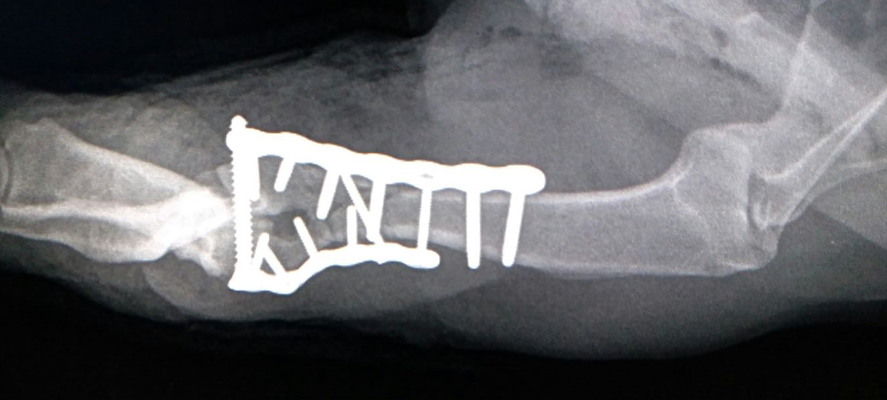 x-rays